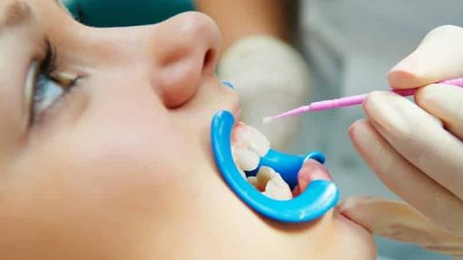 Лечение молочных зубов у детей в Минске
